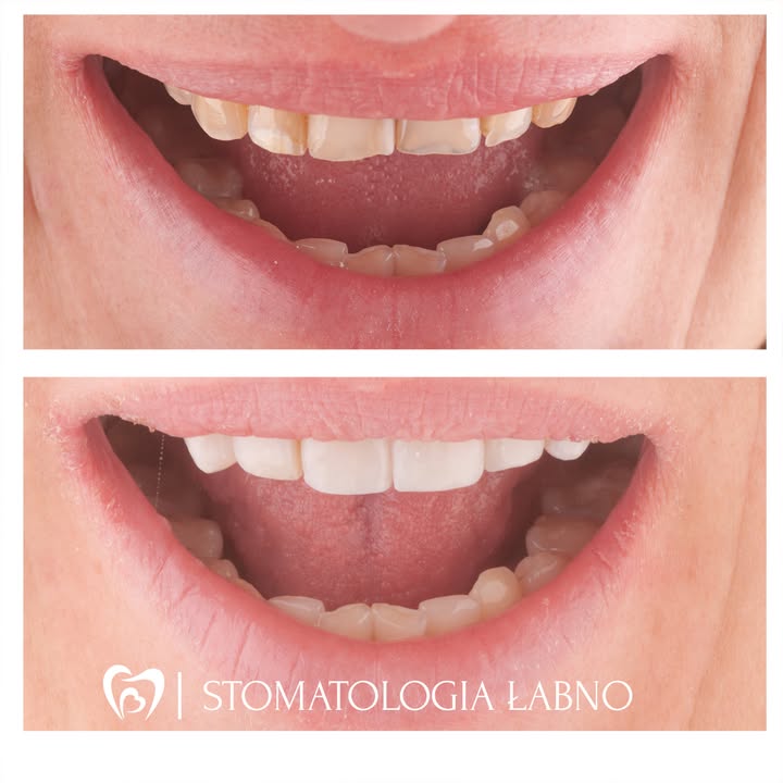Stomatologia Łabno - aktualności