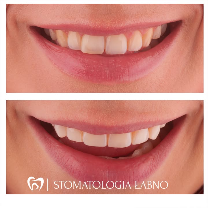 Stomatologia Łabno - aktualności