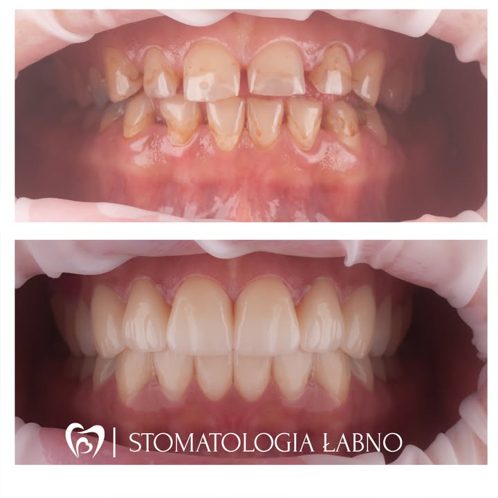 Stomatologia Łabno - aktualności