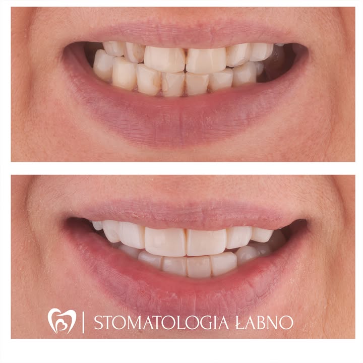 Stomatologia Łabno - aktualności