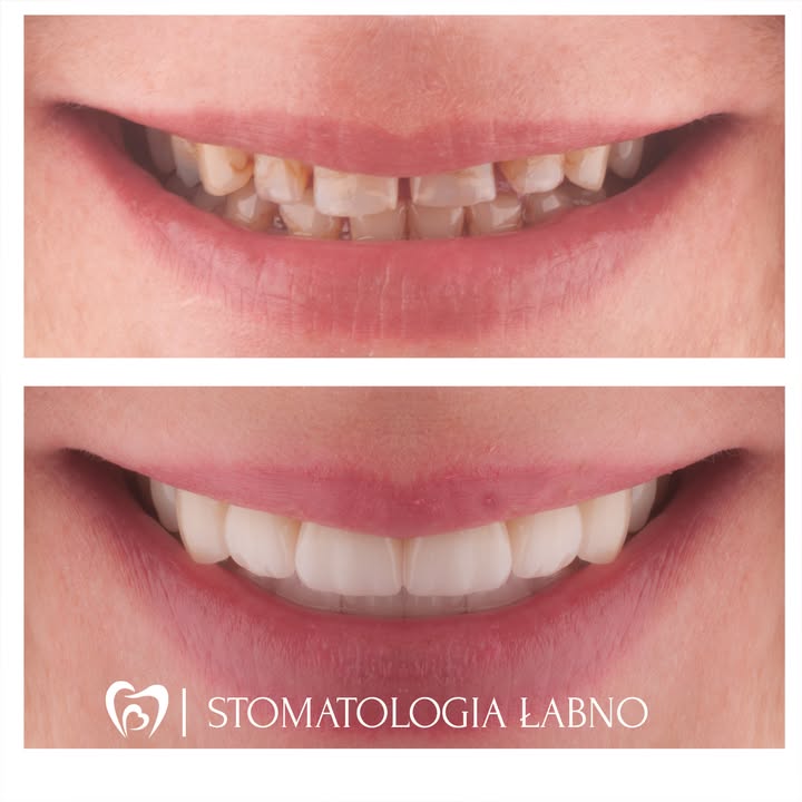 Stomatologia Łabno - aktualności