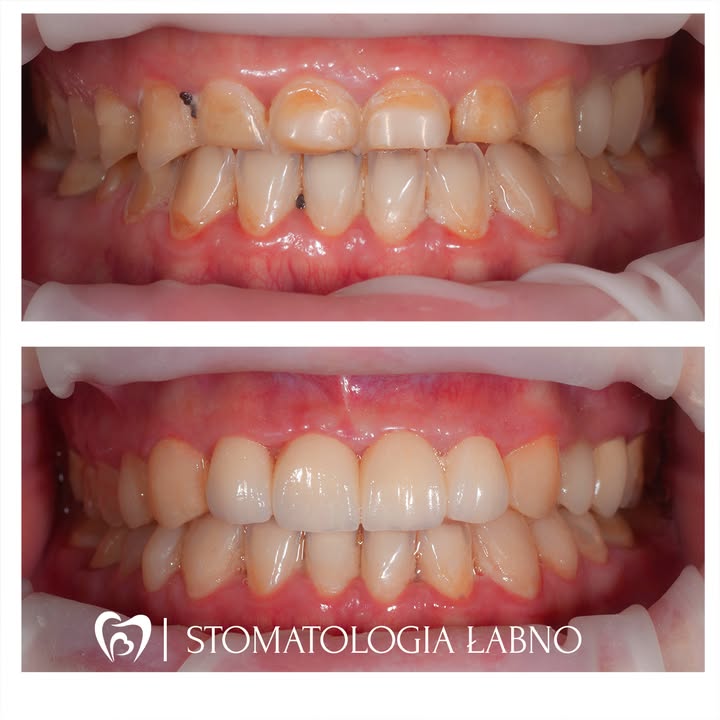 Stomatologia Łabno - aktualności