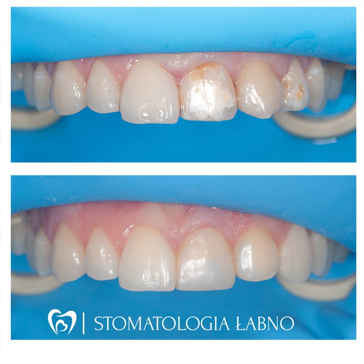 Stomatologia Łabno - aktualności