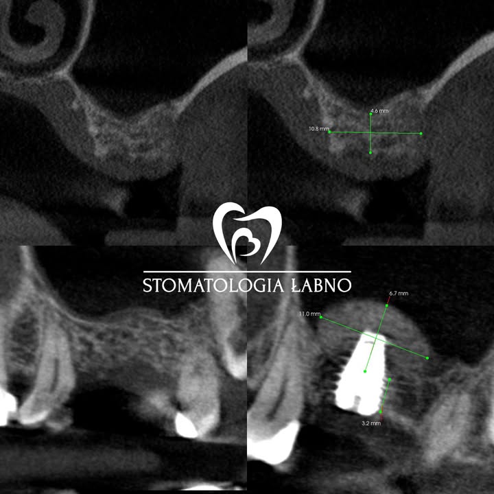 Stomatologia Łabno - aktualności