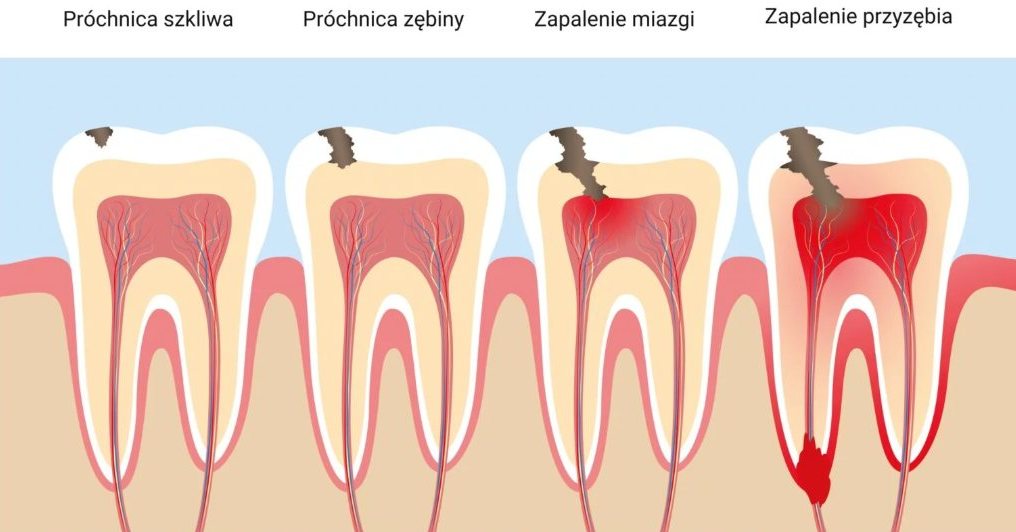 Stomatologia Łabno - aktualności