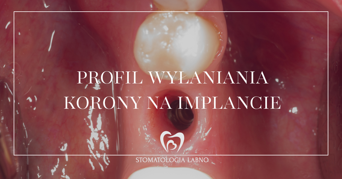 Stomatologia Łabno - aktualności