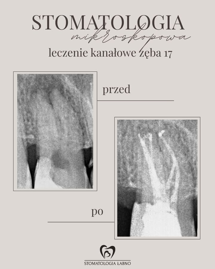 Stomatologia Łabno - aktualności