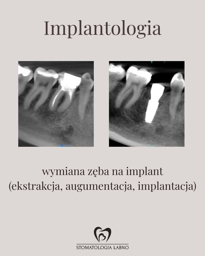 Stomatologia Łabno - aktualności