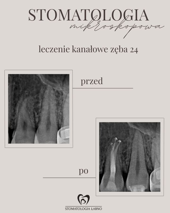 Stomatologia Łabno - aktualności