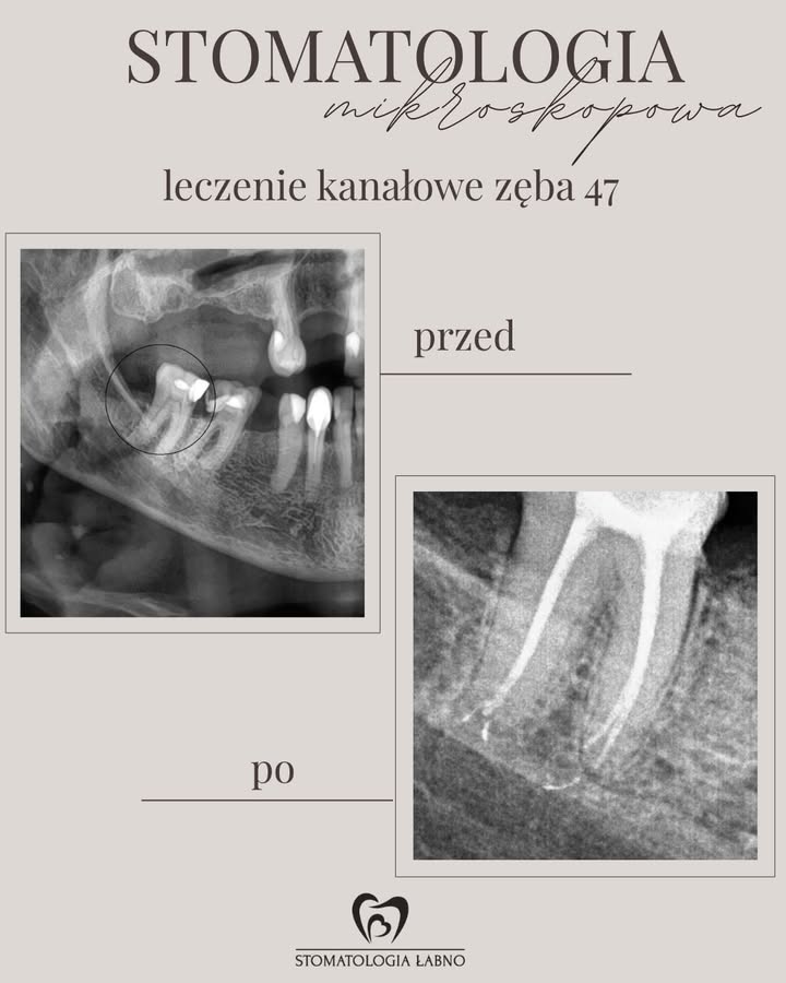 Stomatologia Łabno - aktualności