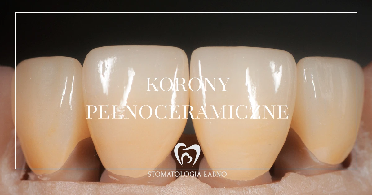 Przypadek leczenia w Stomatologii Łabno